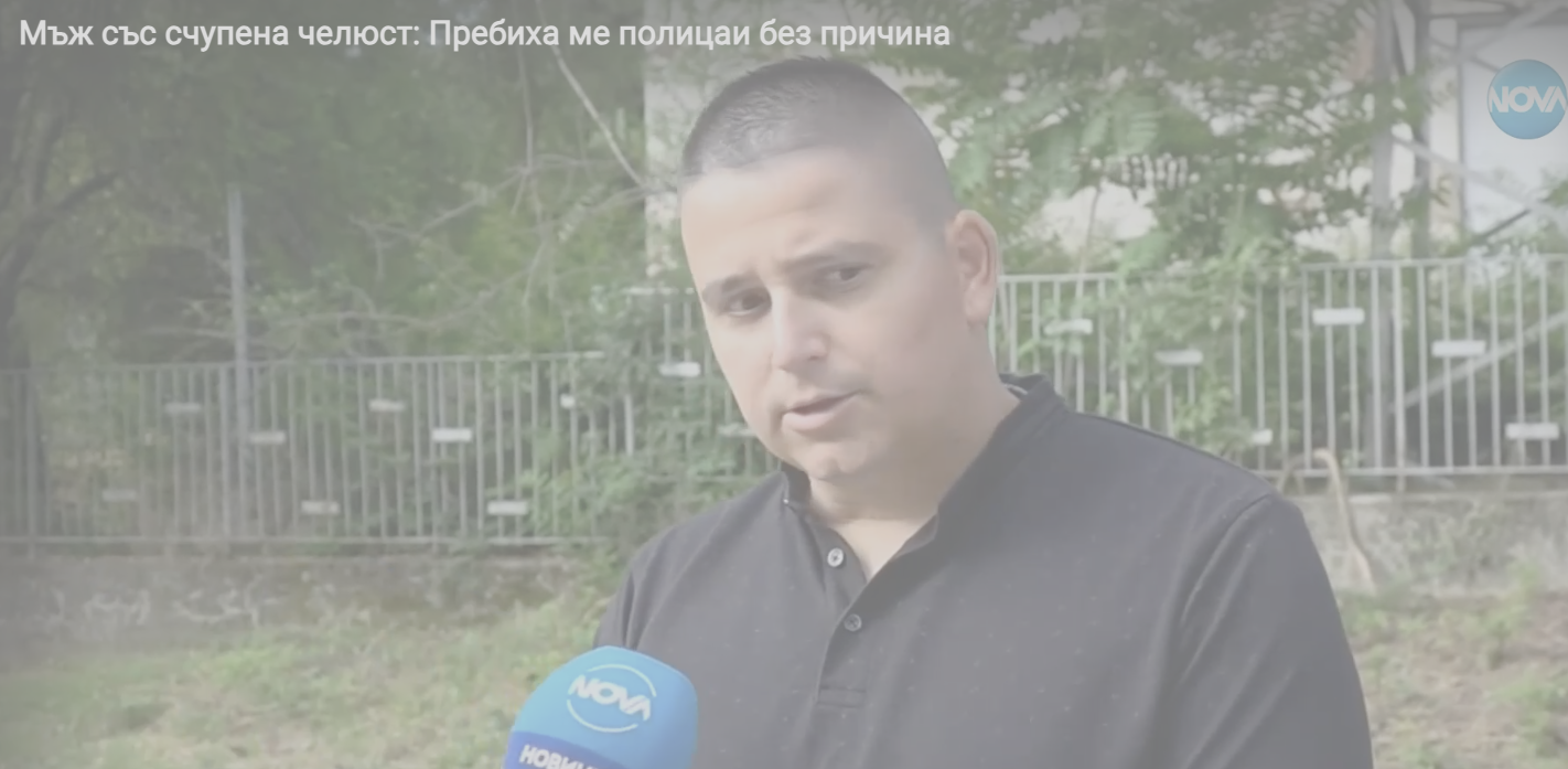 Мъж със счупена челюст: Пребиха ме полицаи без причина